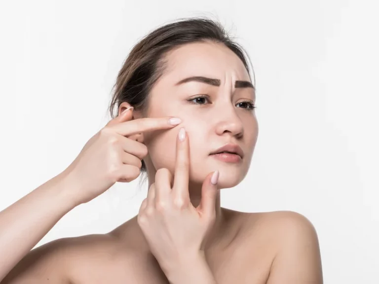 5 Cara Menyamarkan Pori-Pori dengan Skincare dan Makeup, Ampuh!