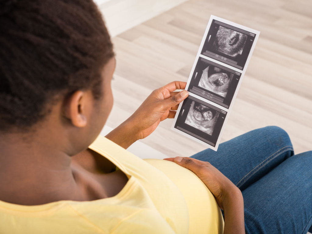 USG Berlebihan Tidak Berbahaya untuk Kehamilan
