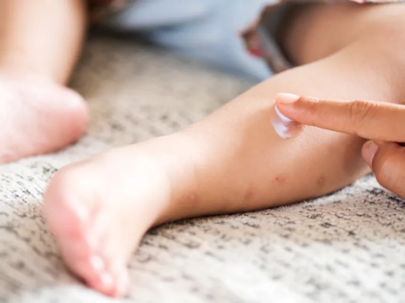 rekomendasi lotion anti nyamuk untuk bayi