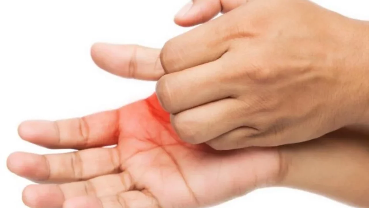 10 Arti Telapak Tangan Kanan Terasa Gatal Berdasarkan Penyebabnya