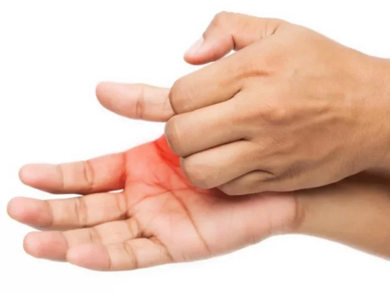 10 Arti Telapak Tangan Kanan Terasa Gatal Berdasarkan Penyebabnya